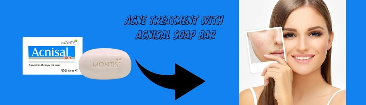 Acne Treatment with Acnisal Soap Bar