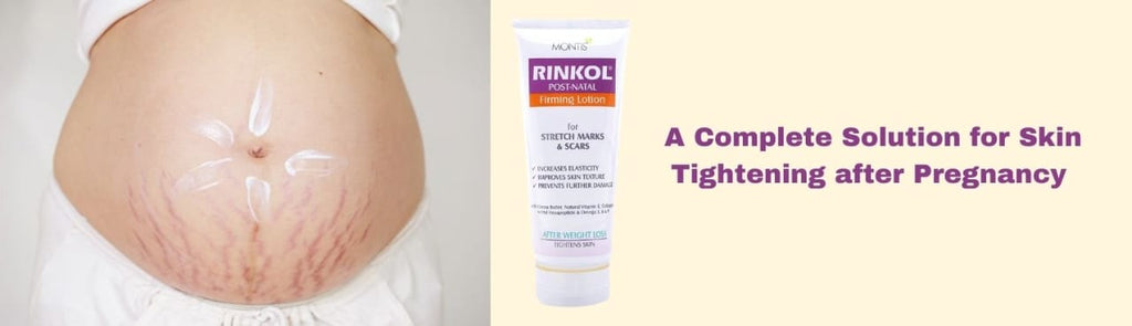 Rinkol Post-Natal Firming Lotion: A Complete Solution for Skin Tightening after Pregnancy