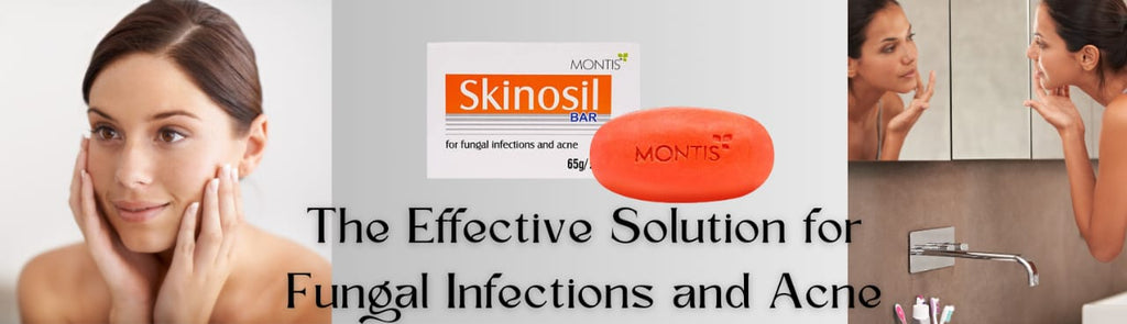 Skinosil Bar: The Effective Solution for Fungal Infections and Acne